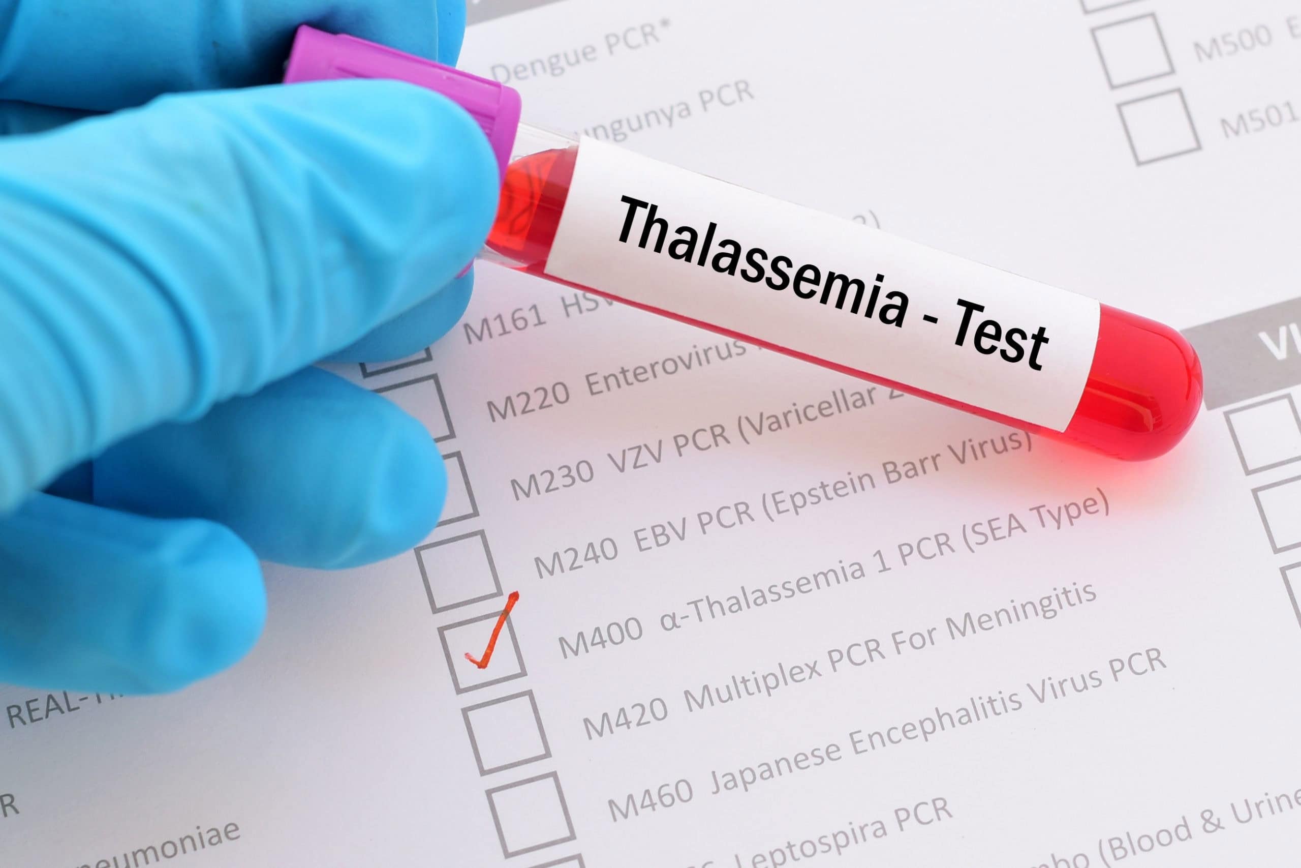 Punjab makes genetic testing mandatory for student admissions under new law