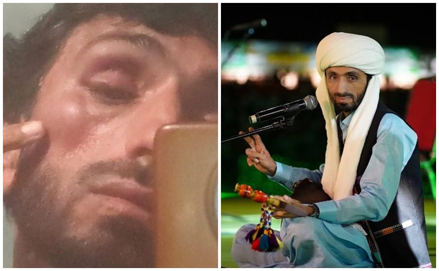 Singer Wahab Bugti Assaulted By Balochistan Ministers Son In Naseerabad