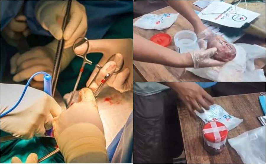Kidney In Womans Handbag Midnight Raid In Kasur Exposes Illgal Organ Transplant Network